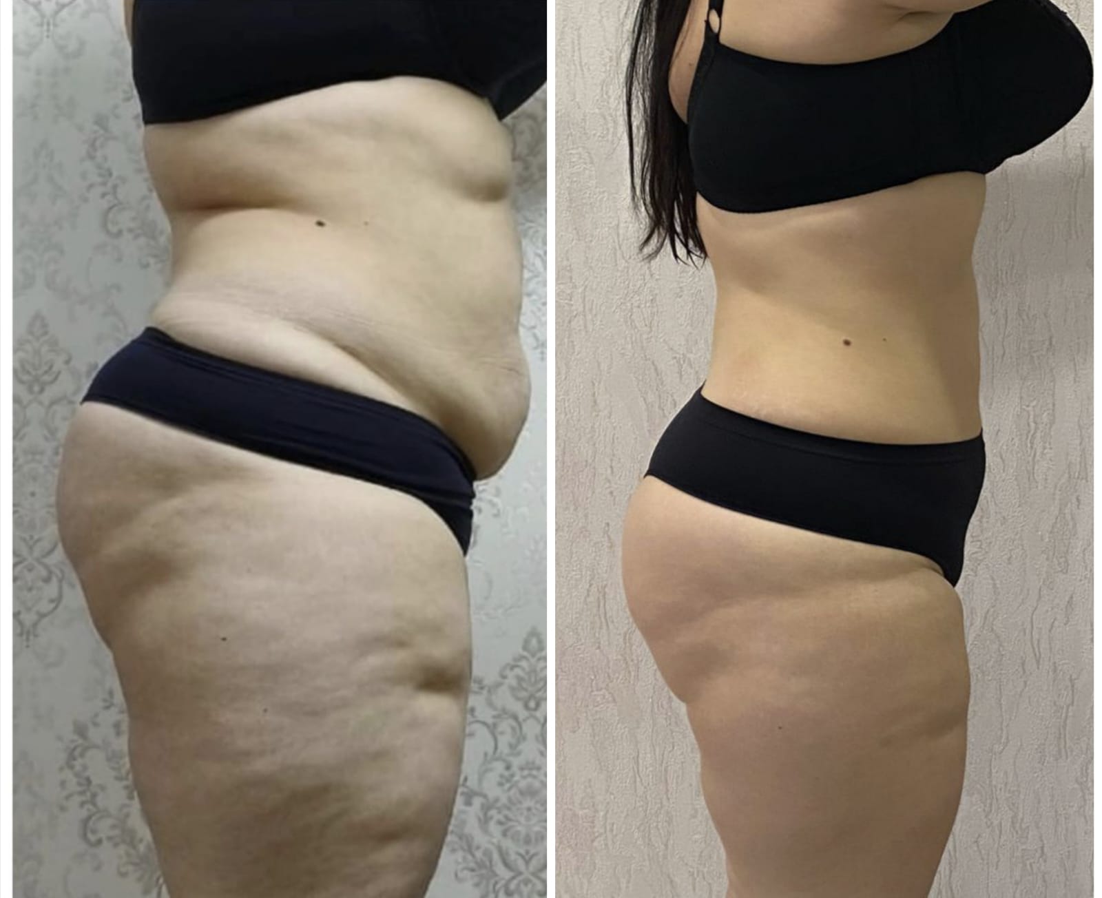 Коррекция фигуры: до и после