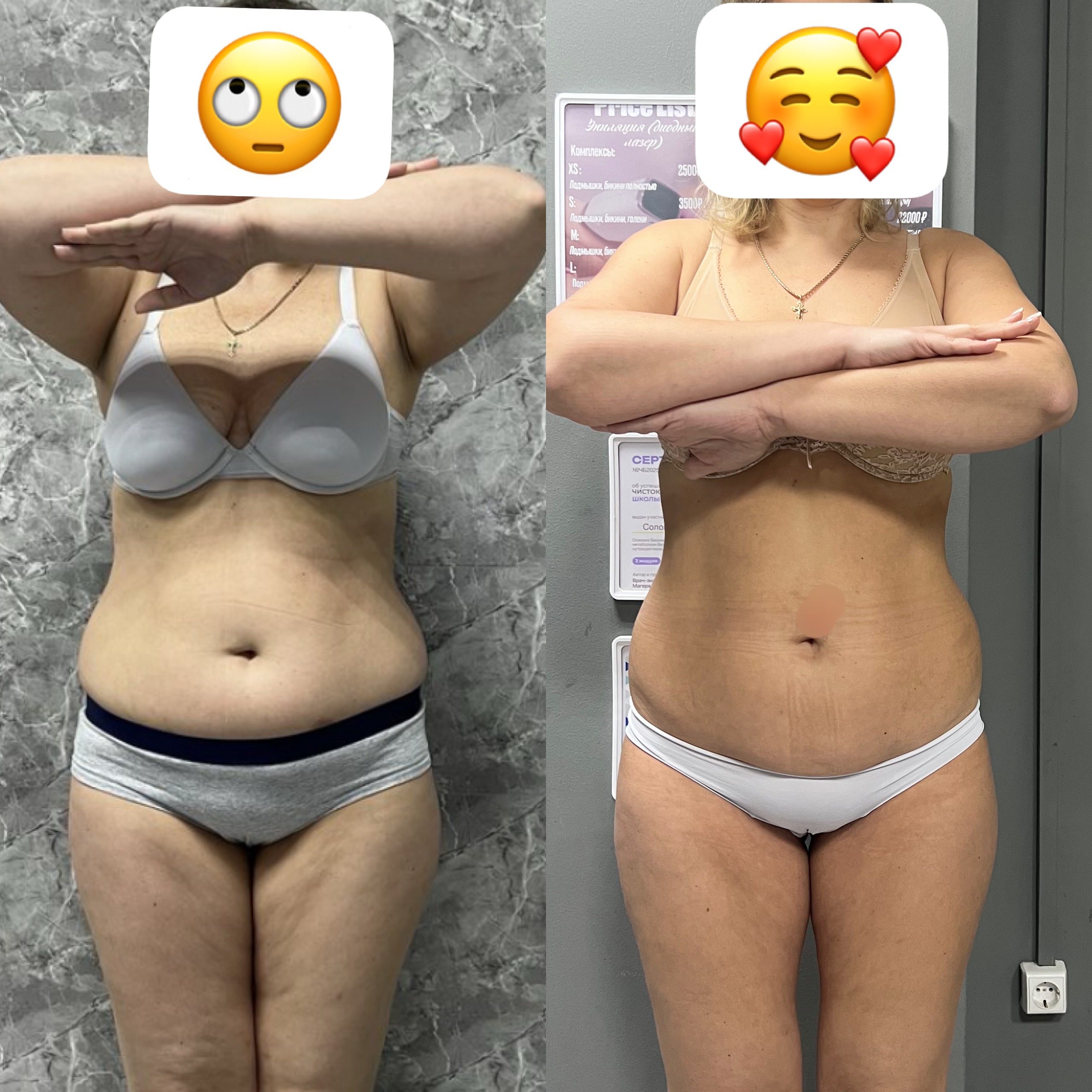 Коррекция фигуры: до и после